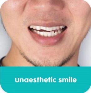 Kasmo-specialties-Prosthetic Dentistry (5)