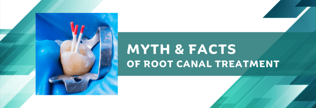 myth and facts of root canal treatment