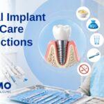 dental-implant-after-care-instructions