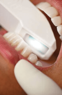 Implant Dentistry